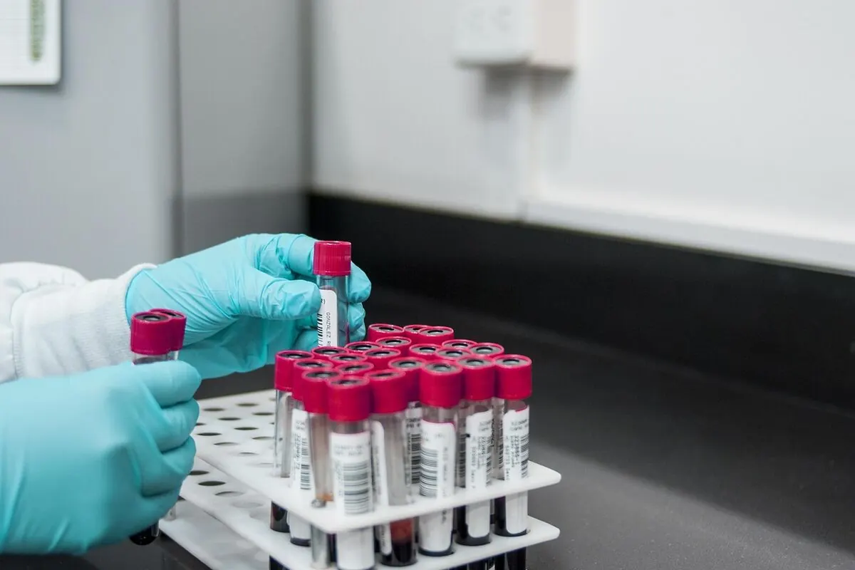 Blood test tubes in a clinical laboratory used for alkaline phosphatase and liver panel testing